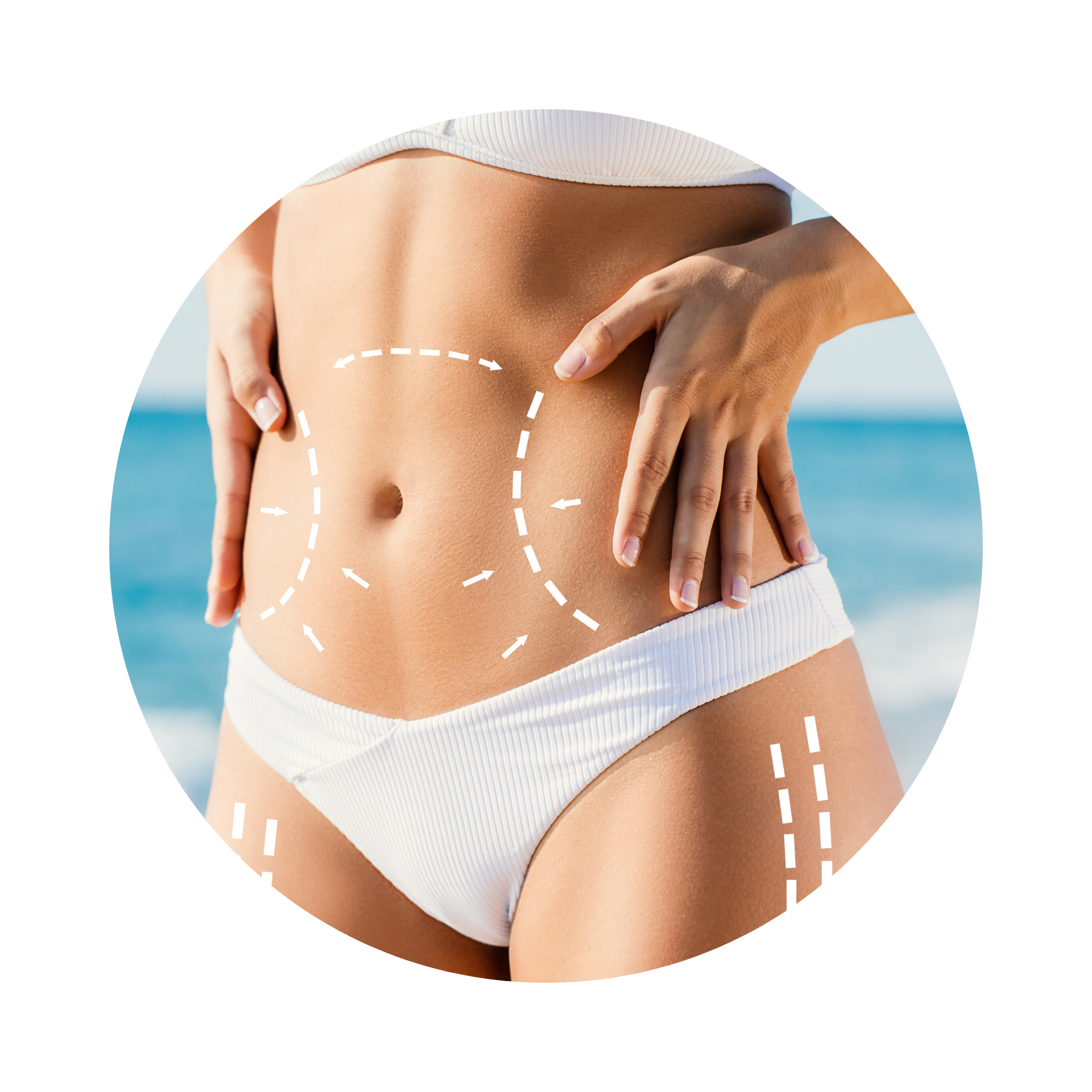 coolsculpting