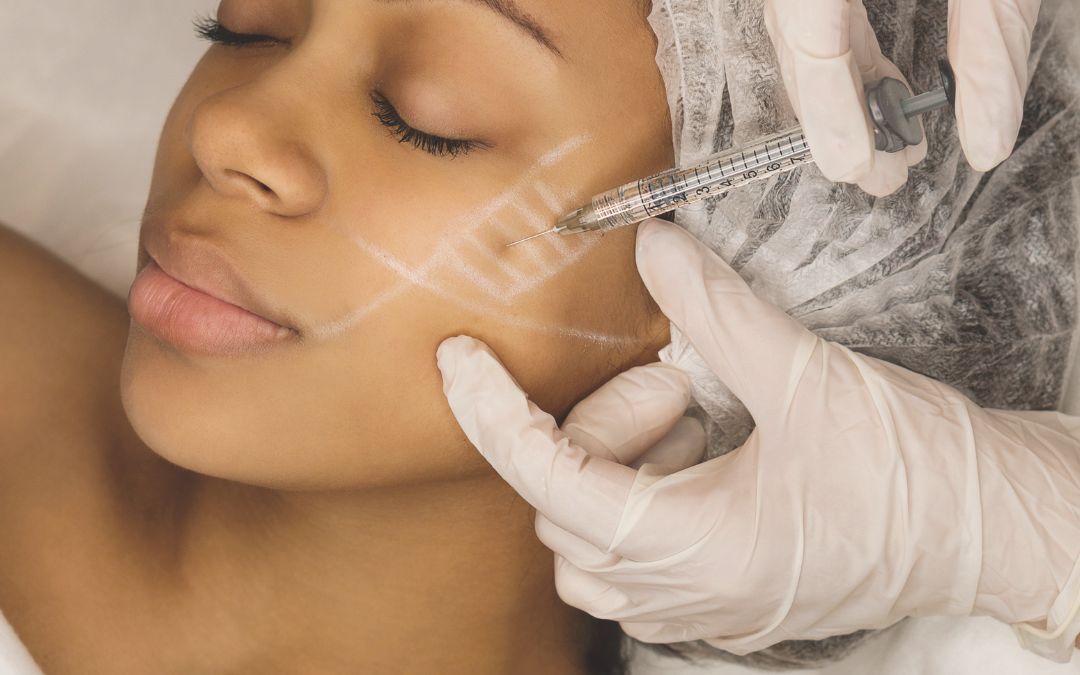 Facial DERMAL FILLER